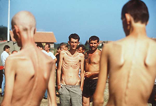 Bosnian Genocide (1992), Bosnian Muslim (Bosniak) prisoners in Trnopolje concentration camp near Prijedor.
