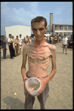 Bosnian Genocide (1992), Bosnian Muslim (Bosniak) Prisoner in Trnopolje concentration camp near Prijedor.